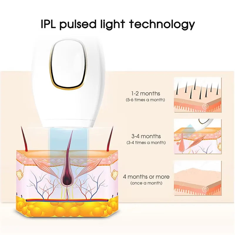Opaline - IPL Laser Hair Removal